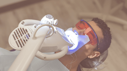 Why Teeth Whitening is Best Done at the Dentist