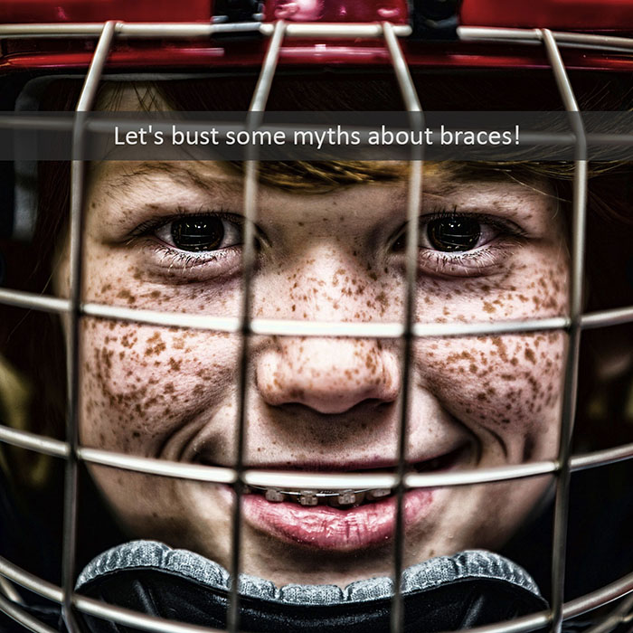Let’s Bust Some Myths About Braces!
