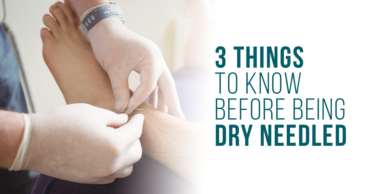 6 Things to Know About Dry Needling