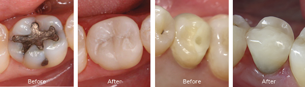 Before and After double shots 600x200 - 2