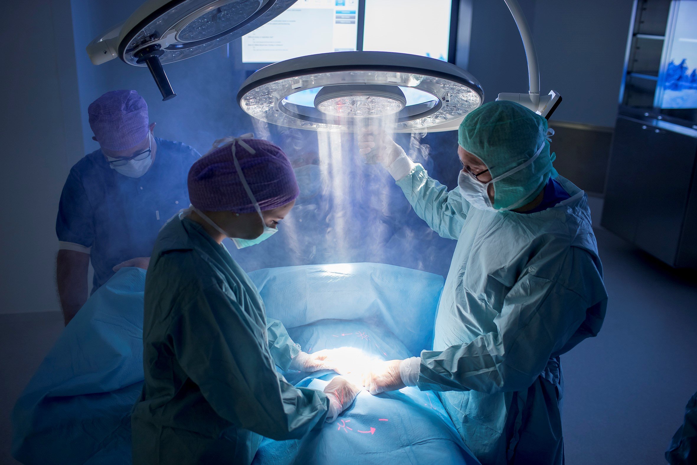 Surgical Light Airflow in Operating Theatre